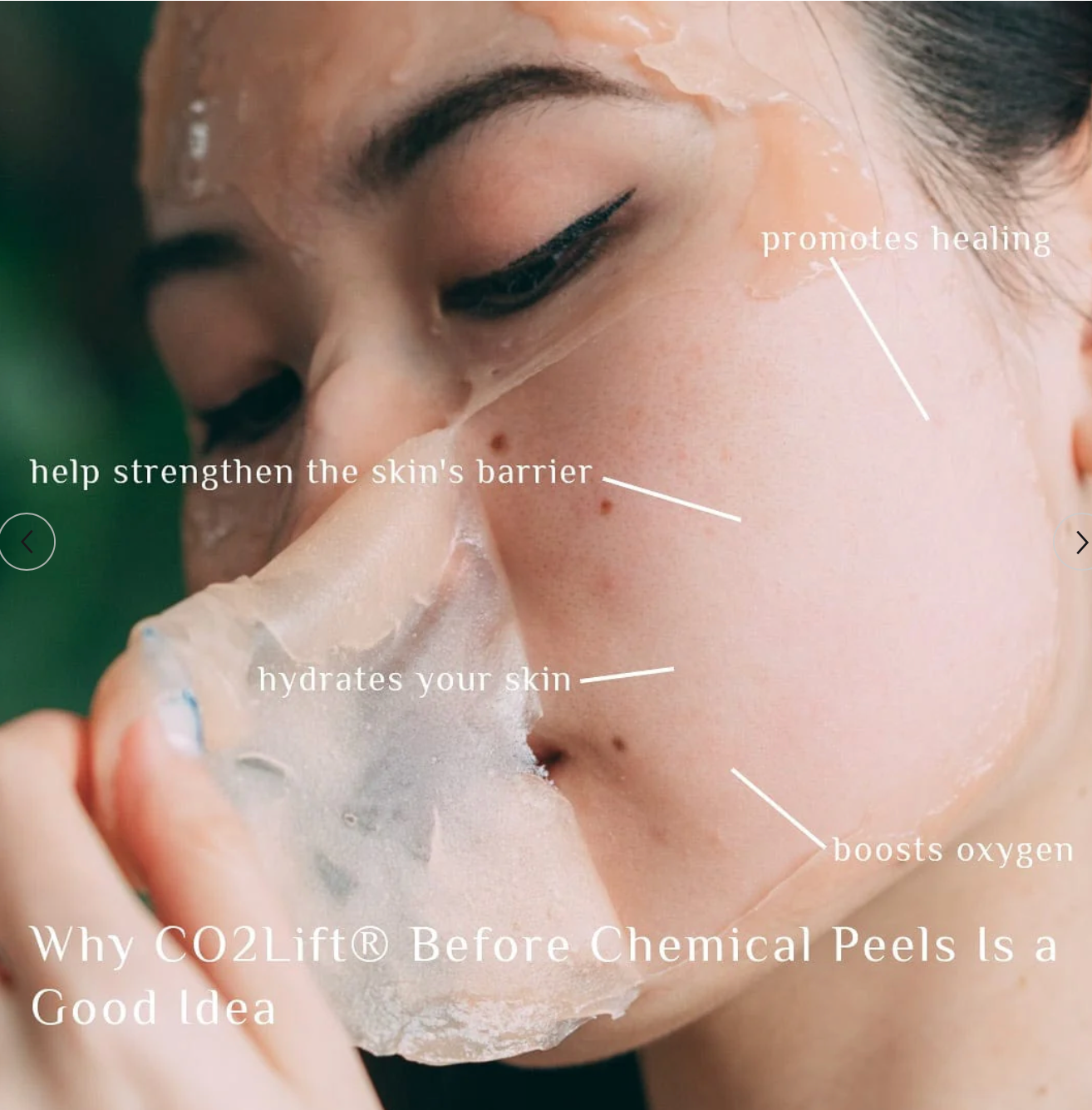 CO2 Lift Pro- Face, Eyes, Neck Body Carboxy Gel (3 Applications)